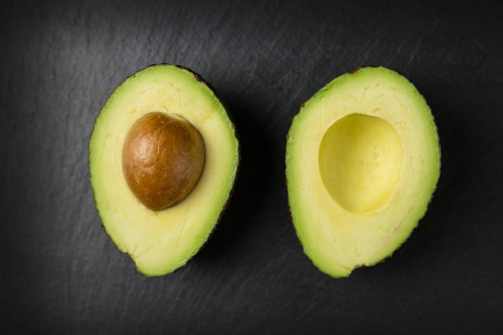Can You Eat Avocado on the Mediterranean Diet?