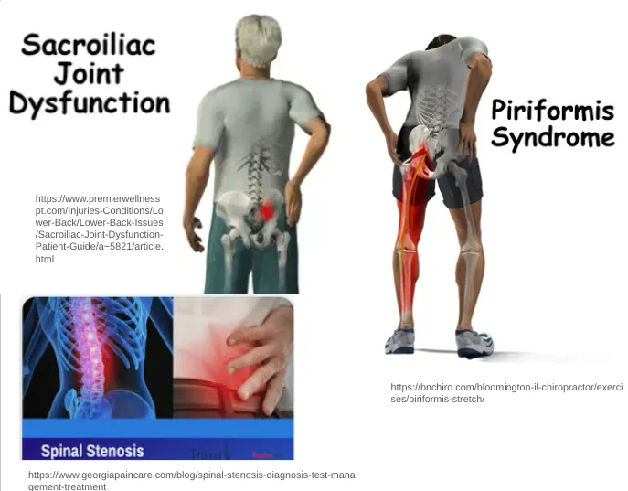 “Take What the Defense Gives You” – BionicOldGuy “Take What the Defense Gives You” – BionicOldGuy