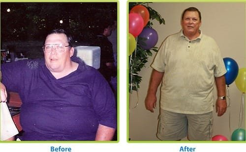 Before and After