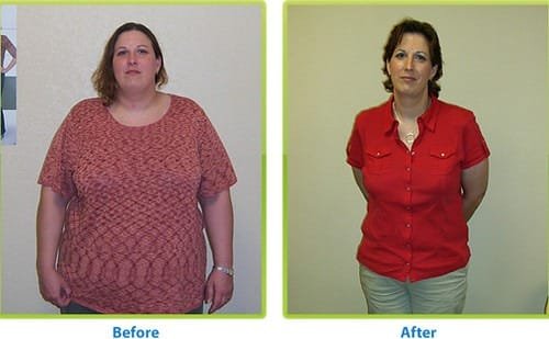 Before and After
