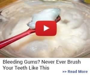The Truth About Bleeding Gums: Why Your Brushing Technique Matters