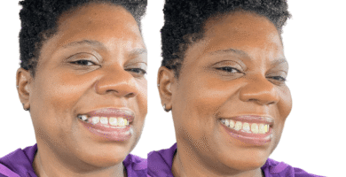 ProDentim: New Breakthrough for Gum Support and Bad Breath Relief